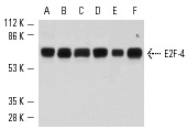 E2F-4 (C-20): sc-866. Western blot analysis of E2F-4 expression in MM-142 (A), 3611-RF (B), HeLa (C), A-431 (D), Y79 (E) and A-673 (F) nuclear extracts.