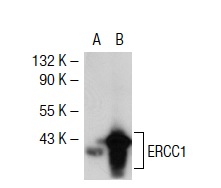 ERCC1 (D-10): sc-17809. Western blot analysis of ERCC1 expression in non-transfected: sc-117752 (A) and human ERCC1 transfected: sc-116554 (B) 293T whole cell lysates.