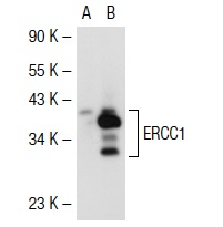 ERCC1 (D-10): sc-17809. Western blot analysis of ERCC1 expression in non-transfected: sc-117752 (A) and mouse ERCC1 transfected: sc-126803 (B) 293T whole cell lysates.