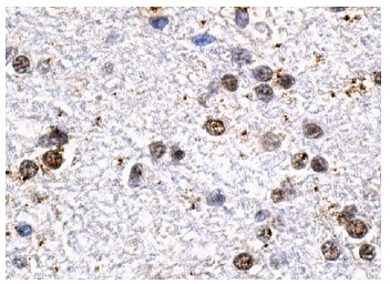 ERCC1 (D-10): sc-17809. Immunoperoxidase staining of formalin fixed, paraffin-embedded human brain tissue showing nuclear staining of neuronal and glial cells.