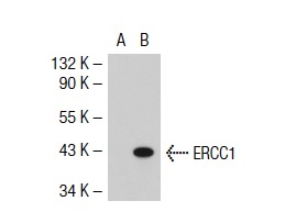 ERCC1 (8F1): sc-56673. Western blot analysis of ERCC1 expression in non-transfected: sc-117752 (A) and human ERCC1 transfected: sc-116554 (B) 293T whole cell lysates.
