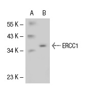 ERCC1 (8F1): sc-56673. Western blot analysis of ERCC1 expression in non-transfected: sc-117752 (A) and mouse ERCC1 transfected: sc-126803 (B) 293T whole cell lysates.