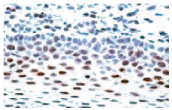 ERCC1 (8F1): sc-56673. Immunoperoxidase staining of formalin-fixed, paraffin-embedded human tonsil tissue showing nuclear localization.