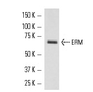 ERM (H-100): sc-22807. Western blot analysis of ERM expression in MCF7 whole cell lysate.