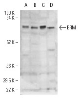 ERM (H-100): sc-22807. Western blot analysis of ERM expression in MDA-MB-468 (A), SK-N-MC (B), HeLa (C) and MCF7 (D) whole cell lysates.