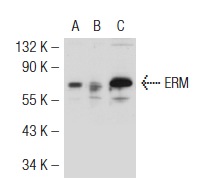 ERM (H-100): sc-22807. Western blot analysis of ERM expression in non-transfected 293T: sc-117752 (A), mouse ERM transfected 293T: sc-120108 (B) and HeLa (C) whole cell lysates.