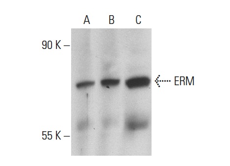 ERM (H-100): sc-22807. Western blot analysis of ERM expression in non-transfected 293T: sc-117752 (A), human ERM transfected 293T: sc-170187 (B) and HeLa (C) whole cell lysates.