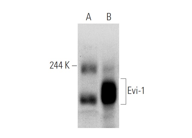 Evi-1 (2331C1a1): sc-130025. Western blot analysis of Evi-1 expression in non-transfected: sc-117752 (A) and human Evi-1 transfected: sc-177200 (B) 293T whole cell lysates.