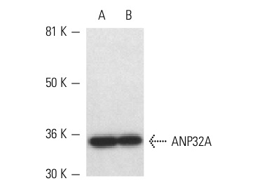 ANP32A (C-18): sc-5652. Western blot analysis of ANP32A expression in LNCaP (A) and Caki-1 (B) whole cell lysates.