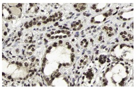 ANP32A (C-18): sc-5652. Immunoperoxidase staining of formalin fixed, paraffin-embedded human kidney tissue showing nuclear and cytoplasmic staining of cells in glomeruli and tubuli. Kindly provided by The Swedish Human Protein Atlas (HPA) program.