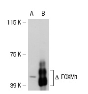 FOXM1 (C-20): sc-502. Western blot analysis of FOXM1 expression in non-transfected: sc-117752 (A) and truncated mouse FOXM1 transfected: sc-120309 (B) 293T whole cell lysates.