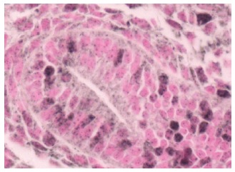 FOXM1 (C-20) Antibody: sc-502. Immunohistochemistry staining of mouse C57Bl/6 fetal lung expressing endogenous FOXM1. Paraffin section shows nuclear localization. Courtesy of Ren, X and Kalinichenko, V.V. unpublished. Cincinnati Children's Hospital Medical Center.