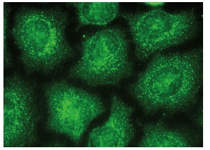 FOXM1 (C-20): sc-502. Immunofluorescence staining of methanol-fixed HeLa cells showing nuclear and cytoplasmic localization.