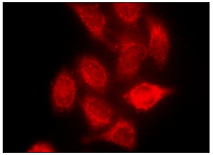 FOXM1 (H-19): sc-501. Immunofluorescence staining of methanol-fixed HeLa cells showing nuclear and cytoplasmic localization.