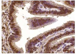 ANP32A (C-18): sc-5652. Immunoperoxidase staining of formalin fixed, paraffin-embedded human lung tissue showing strong nuclear and weak cytoplasmic staining of respiratory epithelial cells.