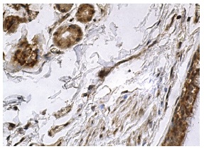 GATA-2 (H-116): sc-9008. Immunoperoxidase staining of formalin fixed, paraffin-embedded human bronchus tissue showing nuclear and cytoplasmic staining of respiratory epithelial cells and glandular cells.