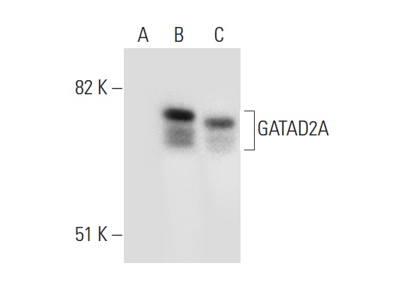 GATAD2A (H-162): sc-134712. Western blot analysis of GATAD2A expression in non-transfected 293T: sc-117752 (A), mouse GATAD2A transfected 293T: sc-120426 (B) and HeLa (C) whole cell lysates.