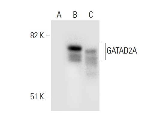 GATAD2A (H-162): sc-134712. Western blot analysis of GATAD2A expression in non-transfected 293T: sc-117752 (A), mouse GATAD2A transfected 293T: sc-120427 (B) and HeLa (C) whole cell lysates.