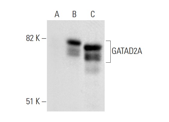 GATAD2A (H-162): sc-134712. Western blot analysis of GATAD2A expression in non-transfected 293T: sc-117752 (A), human GATAD2A transfected 293T: sc-370033 (B) and HeLa (C) whole cell lysates.