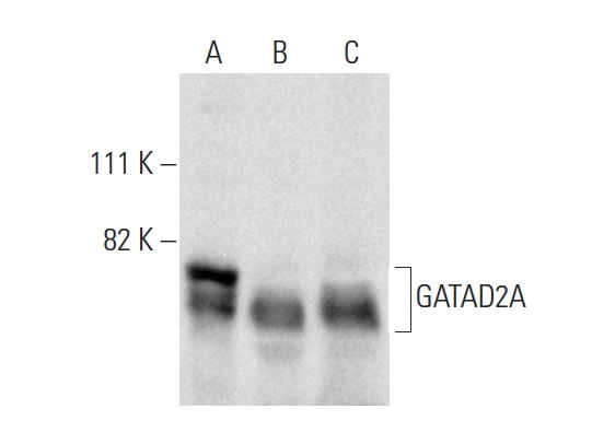 GATAD2A (H-162): sc-134712. Western blot analysis of GATAD2A expression in THP-1 (A) and Hep G2 (B) whole cell lysates and human liver tissue extract (C).