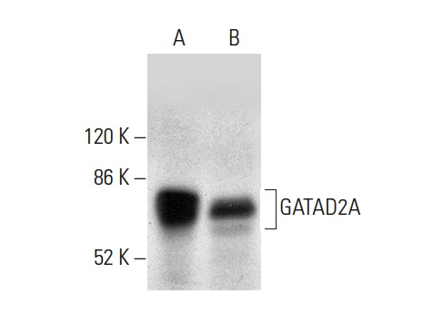 GATAD2A (H-162): sc-134712. Western blot analysis of GATAD2A expression in Jurkat (A) and Hep G2 (B) whole cell lysates.
