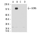 GCN5 (H-75): sc-20698. Western blot analysis of 293 cells transfected with pEBB (A), pEBB/GCN5 (B), pCMV (C) or pCMV/PCAF (D). Kindly provided by Dr. Xicheng Mao, Burstein Lab, University of Michigan.