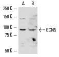 GCN5 (H-75): sc-20698. Western blot analysis of GCN5 expression in K-562 (A) and HeLa (B) nuclear extracts.