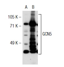 GCN5 (H-75): sc-20698. Western blot analysis of GCN5 expression in non-transfected: sc-117752 (A) and human GCN5 transfected: sc-115465 (B) 293T whole cell lysates.