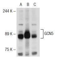 GCN5 (H-75): sc-20698. Western blot analysis of GCN5 expression in non-transfected 293T: sc-117752 (A), human GCN5 transfected 293T: sc-115465 (B) and K-562 (C) whole cell lysates.