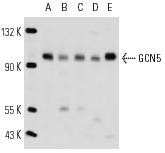 GCN5 (N-18): sc-6303. Western blot analysis of GCN5 expression in K-562 (A), HeLa (B), MCF7 (C), NIH/3T3 (D) and UV treated HeLa (E) nuclear extracts.