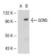 GCN5 (N-18): sc-6303. Western blot analysis of GCN5 expression in non-transfected: sc-117752 (A) and human GCN5 transfected: sc-111723 (B) 293T whole cell lysates.