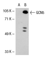 GCN5 (N-18): sc-6303. Western blot analysis of GCN5 expression in non-transfected: sc-117752 (A) and human GCN5 transfected: sc-115465 (B) 293T whole cell lysates.