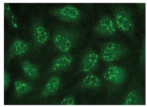 GCN5 (N-18): sc-6303. Immunofluorescence staining of methanol-fixed HeLa cells showing nuclear localization.