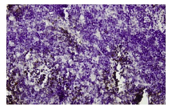 Gfi-1 (15-8): sc-101053. Immunoperoxidase staining of formalin-fixed, paraffin-embedded human lymph node tissue showing nuclear and cytoplasmic localization.