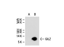 GILZ (FL-134): sc-33780. Western blot analysis of GILZ expression in non-transfected: sc-110760 (A) and human GILZ transfected: sc-112944 (B) 293 whole cell lysates.