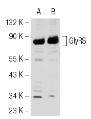 GlyRS (H-300): sc-98614. Western blot analysis of GlyRS expression in HeLa (A) and SK-N-MC (B) whole cell lysates.