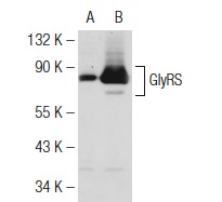 GlyRS (H-300): sc-98614. Western blot analysis of GlyRS expression in non-transfected: sc-117752 (A) and mouse GlyRS transfected: sc-120534 (B) 293T whole cell lysates.