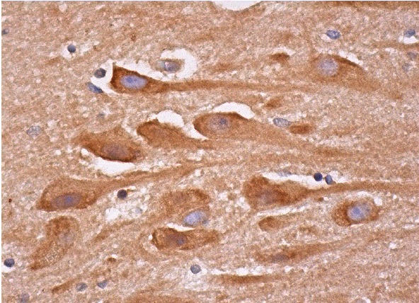 GlyRS (H-300): sc-98614. Immunoperoxidase staining of formalin fixed, paraffin-embedded human hippocampus tissue showing cytoplasmic staining of neuronal cells and glial cells.