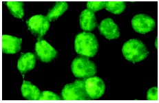 HAT1 (C-20): sc-8752. Immunofluorescence staining of methanol-fixed HeLa cells showing nuclear localization.