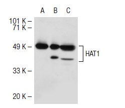 HAT1 (C-20): sc-8752. Western blot analysis of HAT1 expression in non-transfected 293T: sc-117752 (A), human HAT1 transfected 293T: sc-116753 (B) and HeLa (C) whole cell lysates.