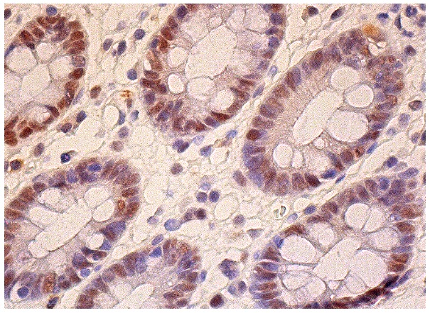 HAT1 (C-20): sc-8752. Immunoperoxidase staining of formalin fixed, paraffin-embedded human colon tissue showing nuclear staining of glandular cells.