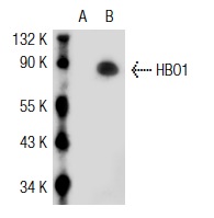 HBO1 (T-20): sc-13284. Western blot analysis of HBO1 expression in non-transfected: sc-117752 (A) and human HBO1 transfected: sc-115259 (B) 293T whole cell lysates.