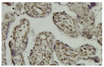 hCAP-D2 (294.1): sc-101012. Immunoperoxidase staining of formalin-fixed, paraffin-embedded human placenta tissue showing nuclear and cytoplasmic localization.