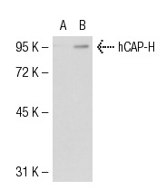 hCAP-H (H-6): sc-101013. Western blot analysis of hCAP-H expression in non-transfected: sc-117752 (A) and mouse hCAP-H transfected: sc-126947 (B) 293T whole cell lysates.