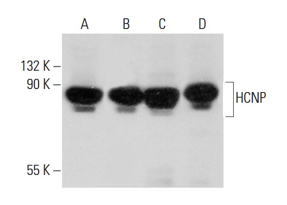 HCNP (C-9): sc-271037. Western blot analysis of HCNP expression in HeLa (A), HEK293 (B), Jurkat (C) and MCF7 (D) whole cell lysates.