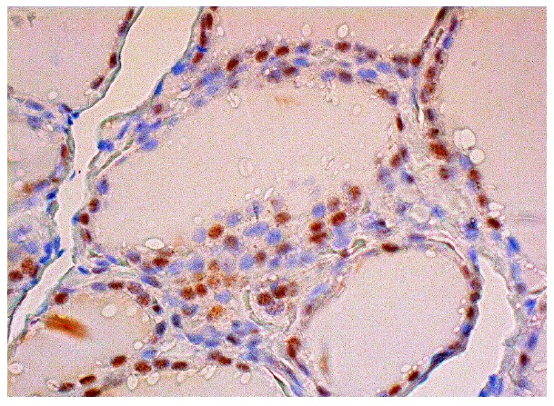 HCNP (C-9): sc-271037. Immunoperoxidase staining of formalin fixed, paraffin-embedded human thyroid gland tissue showing nuclear staining of subset of glandular cells.