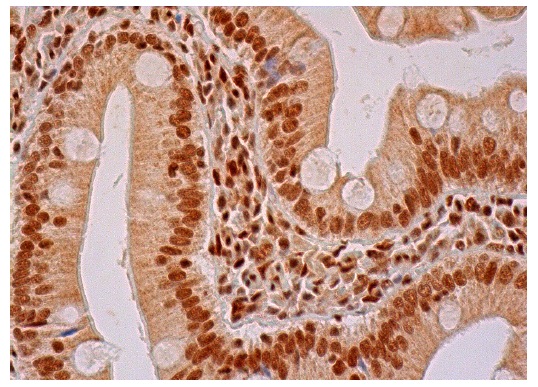 HDAC2 (C-19): sc-6296-R. Immunoperoxidase staining of formalin fixed, paraffin-embedded human duodenum tissue showing nuclear and cytoplasmic staining of glandular cells.