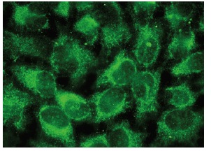 HDAC6 (S-14): sc-5255. Immunofluorescence staining of methanol-fixed HeLa cells showing cytoplasmic localization.