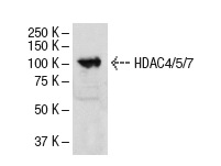 HDAC4/5/7 (H-273): sc-11421. Western blot analysis of HDAC7 expression in NIH/3T3 whole cell lysate.