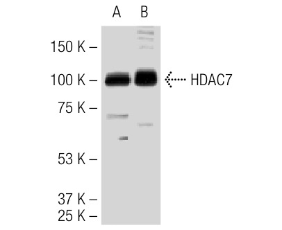 HDAC4/5/7 (H-273): sc-11421. Western blot analysis of HDAC7 expression in NIH/3T3 whole cell lysate (A) and NIH/3T3 nuclear extract (B).